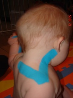 Turn a breach baby with Kinesiology Tape #kinesiologytaoe